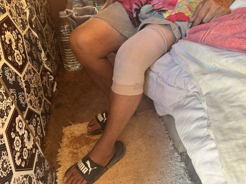 Pierna lesionada de Manolo