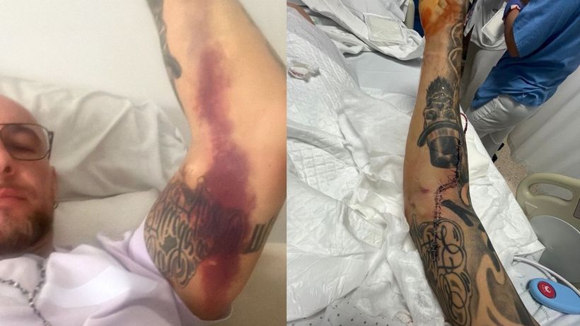 Ricardo pintor apuñalamiento