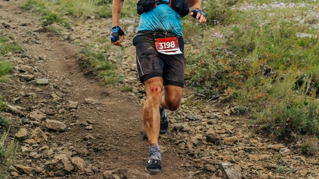 Un conductor se fractura el pie, se da de baja y participa en una prueba de montaña de 41 kilómetros: es despido procedente