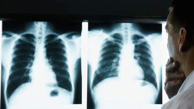 Médico consulta una radiografía