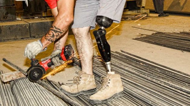Trabajador con una prótesis en la pierna